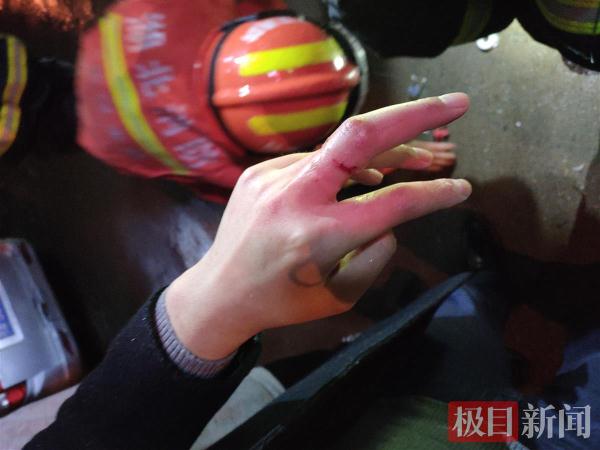 男子中指卡进桶盖无法拔出，“蓝朋友”上门解救