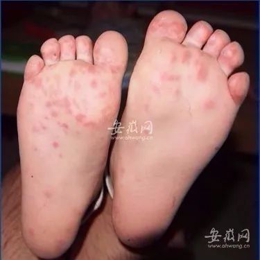 注意！安徽省疾控中心最新提醒！