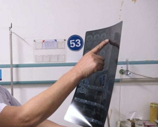 七旬阿婆苦忍“天下第一痛”10年！医生提醒：这种病难自愈