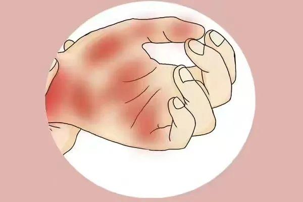 杭州32岁小伙去相亲，女孩父亲一看他的手：相亲缓缓，你赶紧去医院查查吧