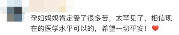 四胞胎两个早产 两个还在妈妈肚里