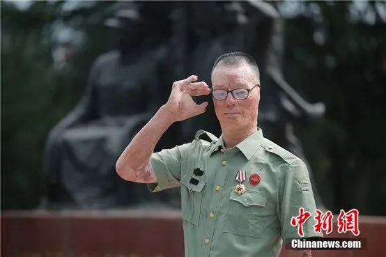 严重毁容的他,浴火重生! 严重毁容的他,浴火重生!