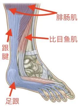 总是足跟痛？你可能患上了跟腱炎