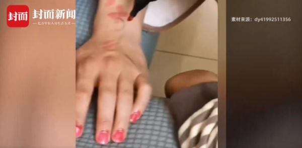 人间真实！男子躺5小时不起被妻子缝沙发上