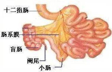 饭后剧烈运动，饭后一动不动，都要小心这种肠道急症