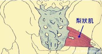腰疼腿麻可不一定是腰脱，也许是这块肌肉出问题？