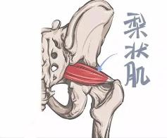 腰疼腿麻可不一定是腰脱，也许是这块肌肉出问题？