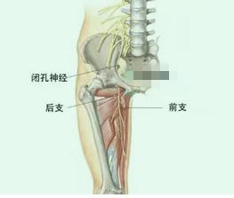 有种膝盖疼，竟是因股骨头坏死而起？