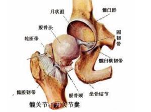 有种膝盖疼，竟是因股骨头坏死而起？
