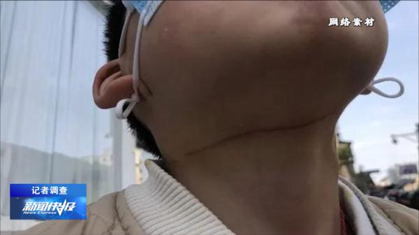 超恐怖！实验告诉你风筝线的杀伤力有多大！家长一定要看！