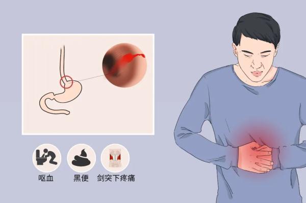 小伙一口气灌下一瓶扎啤，结果吐血1升！医生提醒：千万别逞能