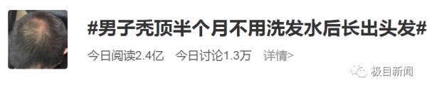 男子秃顶不用洗发水半个月后,网友惊呆了!专家提醒… 男子秃顶不用洗发水半个月后,网友惊呆了!专家提醒…