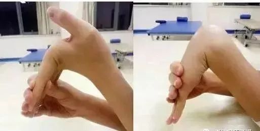 你拿手机是这个姿势吗？别再做了！医生紧急提醒……