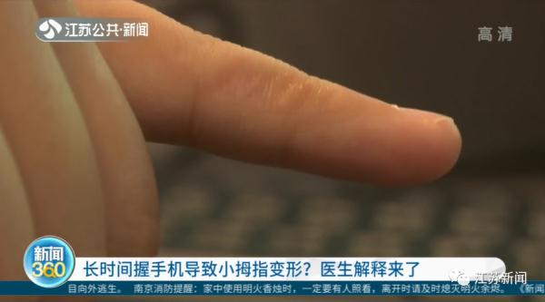 你拿手机是这个姿势吗？别再做了！医生紧急提醒……