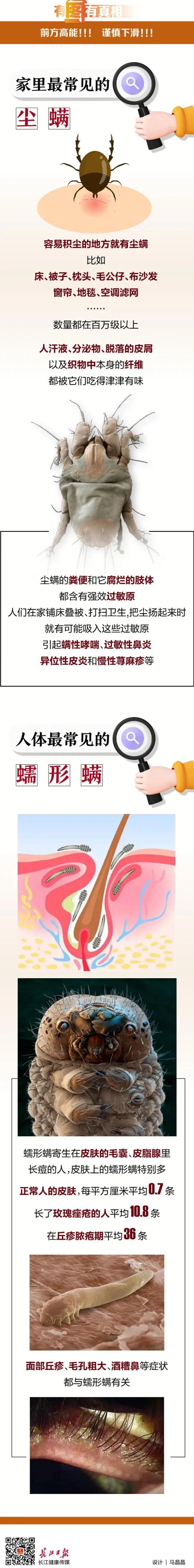 吓人!眼睫毛上爬着58条螨虫!有这些症状的注意了…… 吓人!眼睫毛上爬着58条螨虫!有这些症状的注意了……