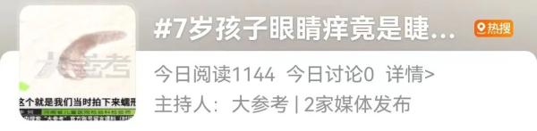 吓人!眼睫毛上爬着58条螨虫!有这些症状的注意了…… 吓人!眼睫毛上爬着58条螨虫!有这些症状的注意了……
