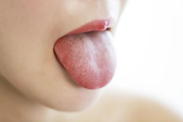 舌苔越干净越好？错！可能暗示你“疾病缠身”！健康的舌苔其实长这样......