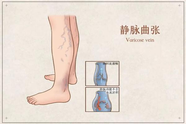 养腿=养命，腿有劲才能寿命长，养腿秘方告诉你了