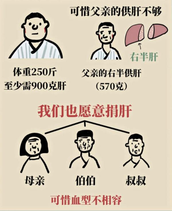 世界首例“双肝移植”!沪250斤“大块头”换上别人不要的肝... 世界首例“双肝移植”!沪250斤“大块头”换上别人不要的肝...