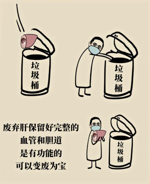 世界首例“双肝移植”!沪250斤“大块头”换上别人不要的肝... 世界首例“双肝移植”!沪250斤“大块头”换上别人不要的肝...