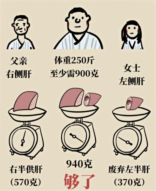 世界首例“双肝移植”!沪250斤“大块头”换上别人不要的肝... 世界首例“双肝移植”!沪250斤“大块头”换上别人不要的肝...