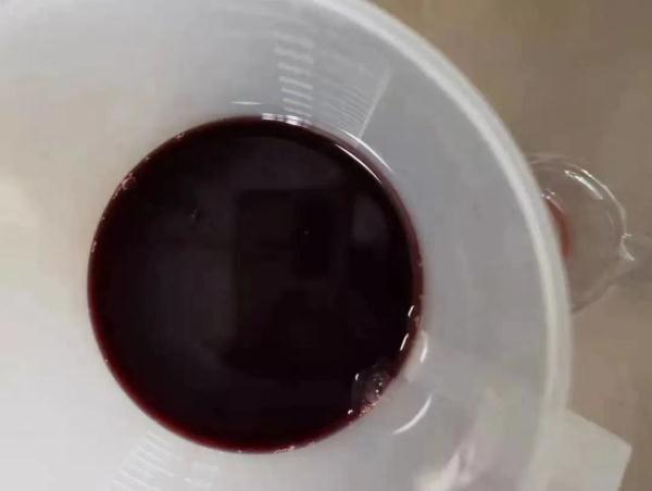 七岁男孩尿出“酱油”高烧不退,原因竟是…… 七岁男孩尿出“酱油”高烧不退,原因竟是……