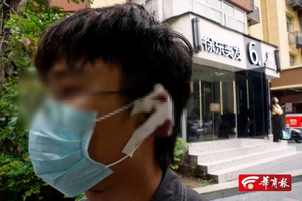 西安一小伙去理发,没想到左耳被剪掉一块肉…医院:已造成不可逆损伤 西安一小伙去理发,没想到左耳被剪掉一块肉…医院:已造成不可逆损伤