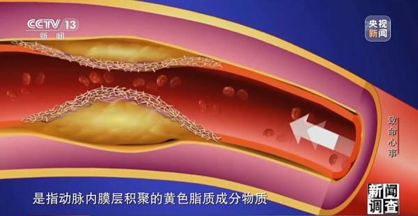 致命“心事” 致命“心事”