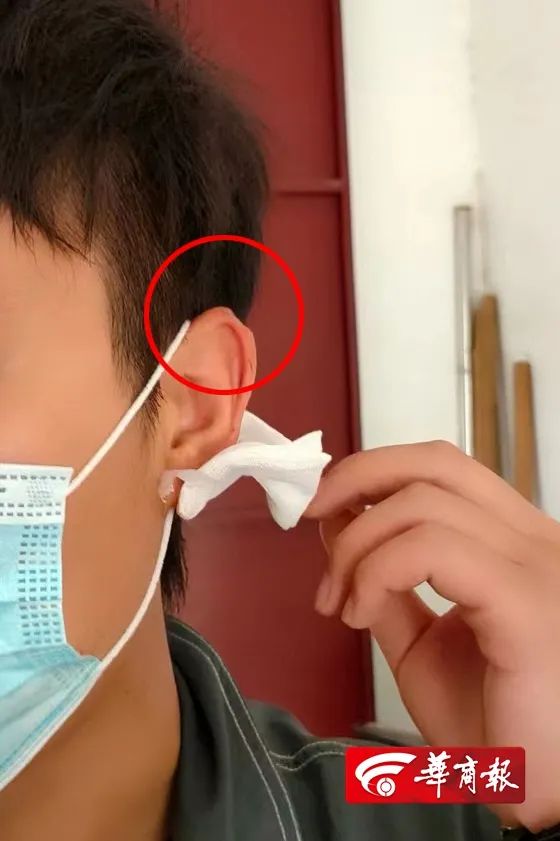 小伙去理发,担心的事情发生了…医院:已造成不可逆损伤 小伙去理发,担心的事情发生了…医院:已造成不可逆损伤