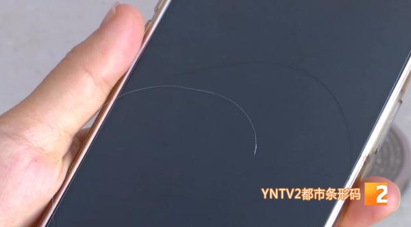 经常拔白发会越来越秃?医生回答:真的! 经常拔白发会越来越秃?医生回答:真的!