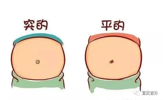 肚脐眼到底能不能抠？