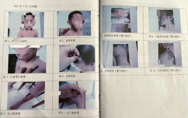 残忍…82万网友在线“揪心”！判了！