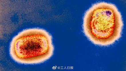 多国报告猴痘病例