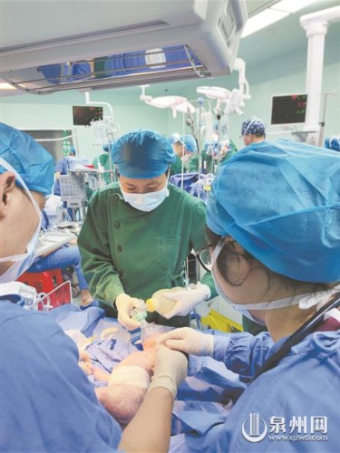 泉州市第一医院生死时速 抢救心脏粘液瘤高危产妇