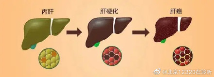 你了解丙肝的危害吗？