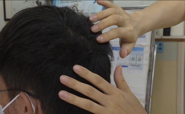 20多岁小伙硬生生把自己拔成“秃头”，真相令人唏嘘