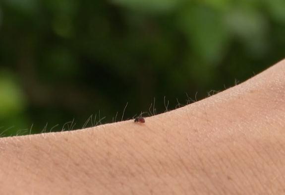 海南人注意!有人被咬后进急诊,这“小虫”公园、路边常见 海南人注意!有人被咬后进急诊,这“小虫”公园、路边常见