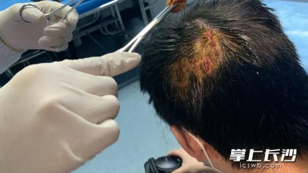 公交站牌玻璃炸裂致候车学生受伤，谁来担责？