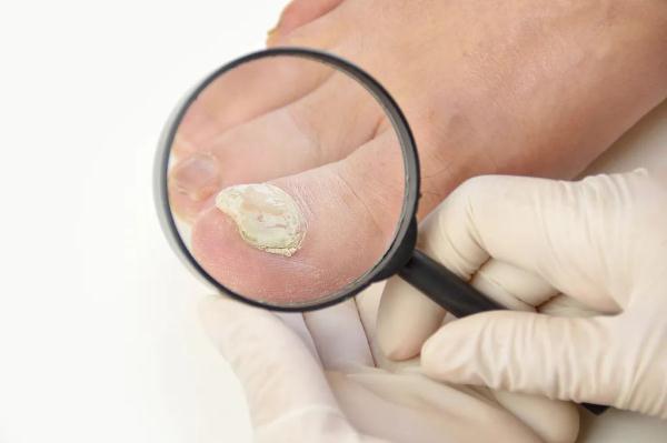 双脚是全身疾病放大镜快看看你的脚有这9个症状别忽视