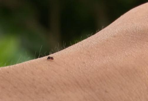 海南人注意!有人被咬后进急诊,这“小虫”公园、路边常见 海南人注意!有人被咬后进急诊,这“小虫”公园、路边常见