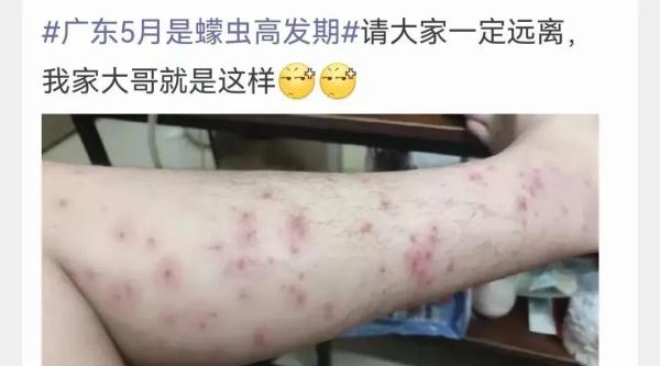 小心这种虫子！有人被咬后进急诊……