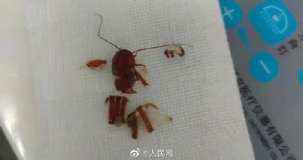 注意！男子半夜睡觉蟑螂爬进耳朵