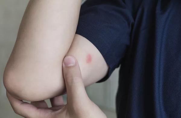 穿这种颜色衣服的人，最招蚊子？！驱蚊小妙招→