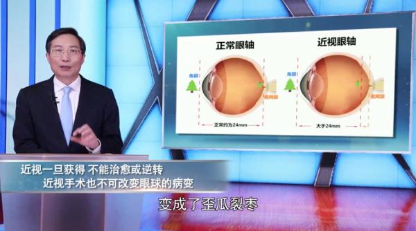 眼科专家透露“治疗近视”真相：近视手术不能治愈近视！