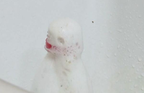 厕所炸了!男子被大面积灼伤,就因为它…… 厕所炸了!男子被大面积灼伤,就因为它……