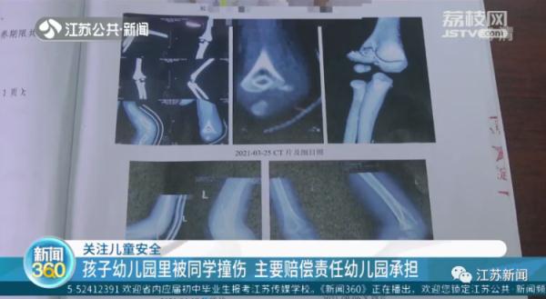 幼童在幼儿园里被同学撞伤，谁担主责？法院这样判！