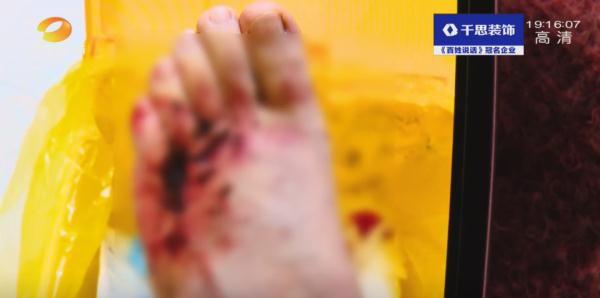 女技师割伤顾客，借花呗赔偿3000元，门店是否担责？