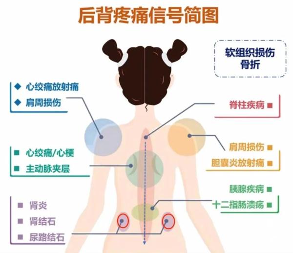 后背疼与多种病有关！一张图看得明明白白