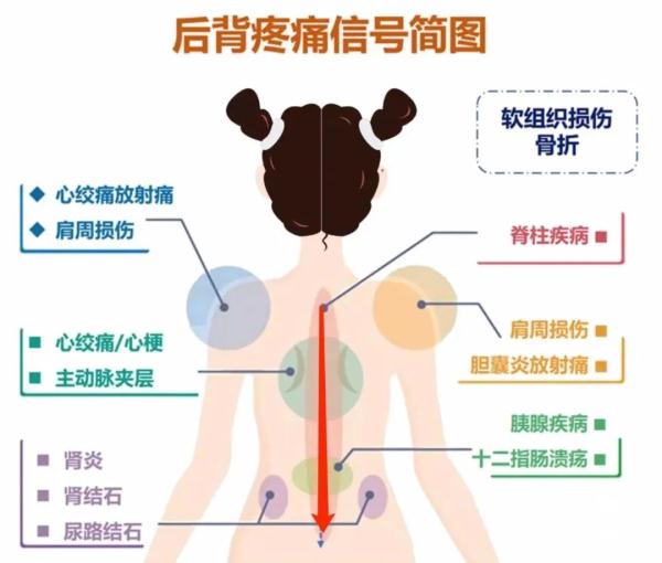 后背疼与多种病有关！一张图看得明明白白