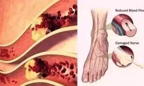 天天拉足背,轻松九十岁!最简单的长寿方法,在家就能做~ 天天拉足背,轻松九十岁!最简单的长寿方法,在家就能做~